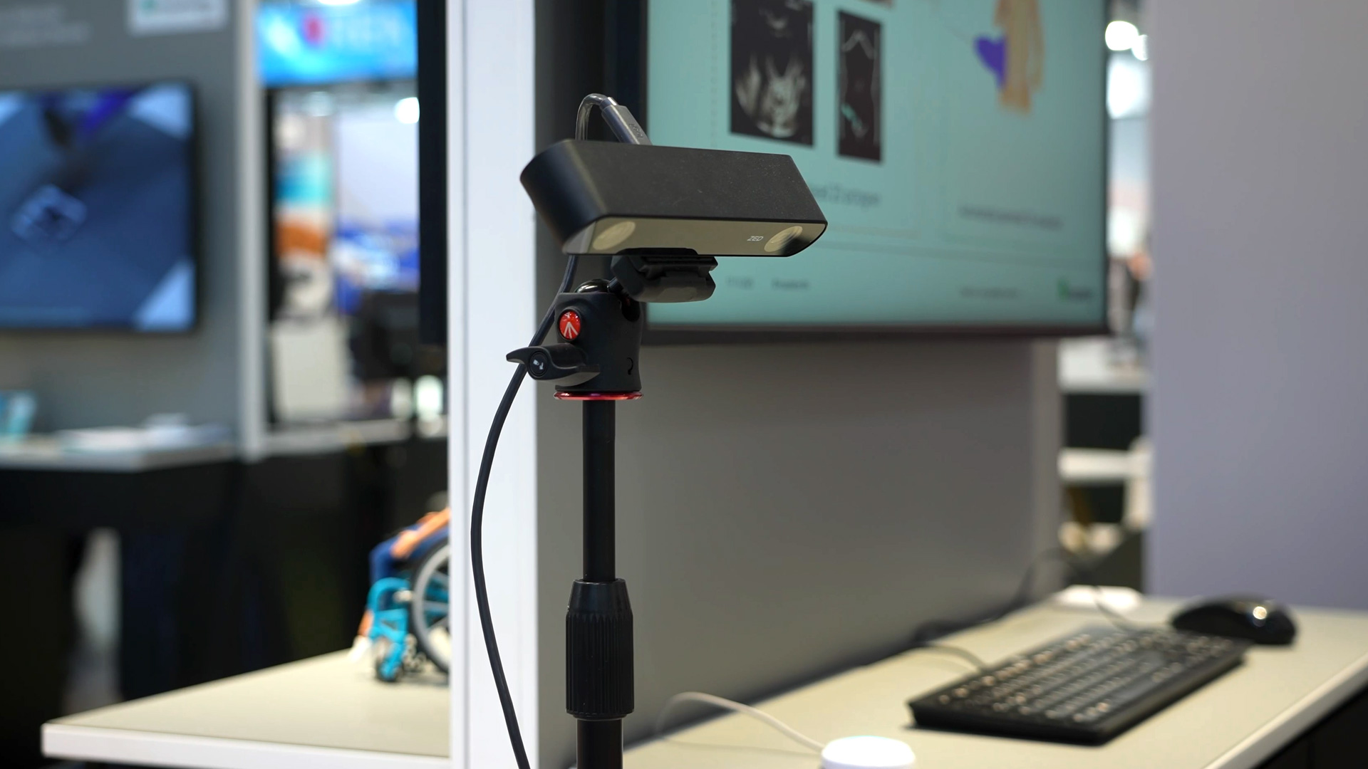 Automatische Dokumentation bei Ultraschalluntersuchung Fraunhofer IPA