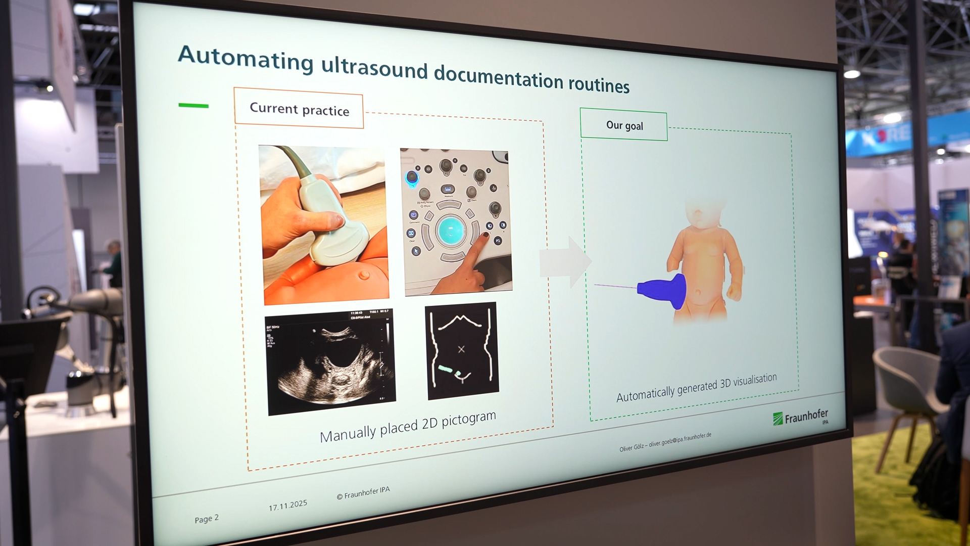 Automatisierung Ultraschalldokumentation als Arbeitsentlastung SonoMap