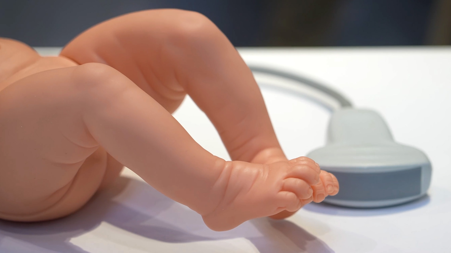 Ultraschallposition automatisiert mit SonoMap bestimmen