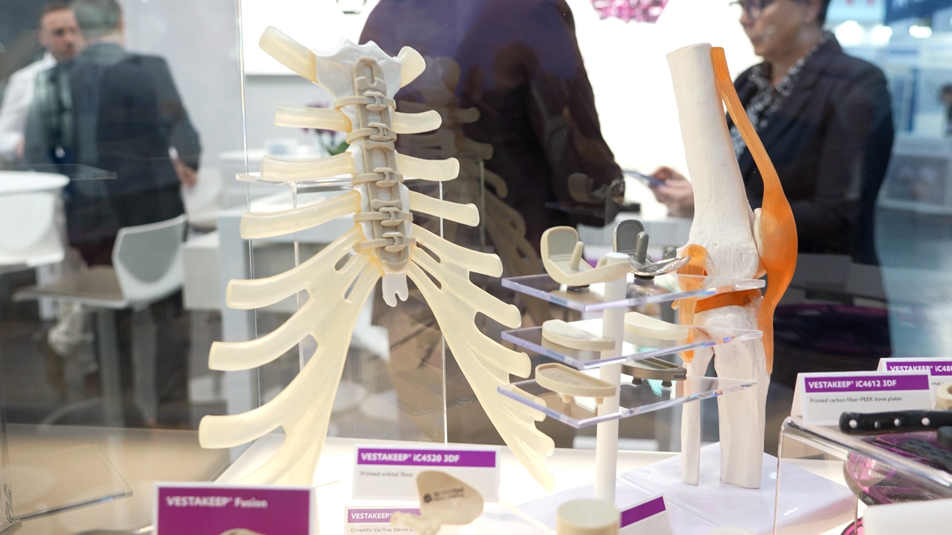 Carbon fiber reinforced PEEK in spinal column and bone reconstruction Evonik
