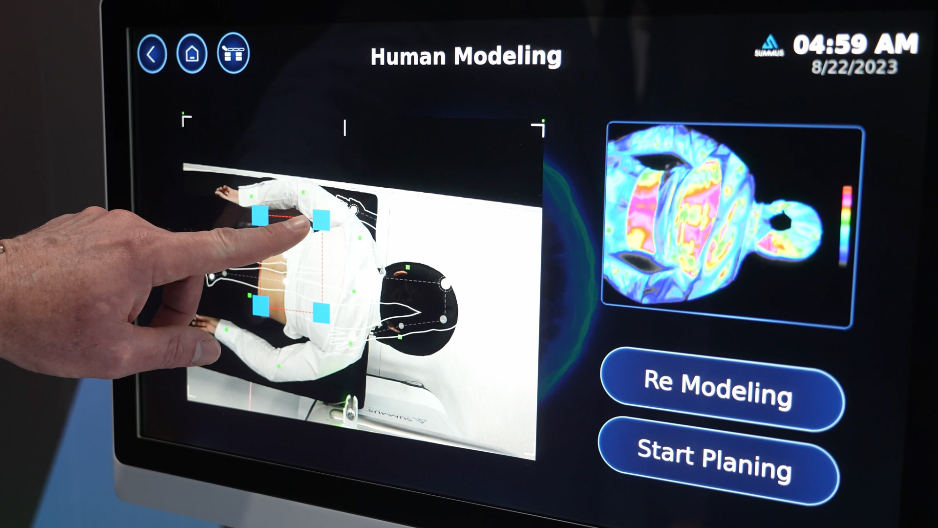 Automated laser treatment relieves doctors and optimizes practice workflows