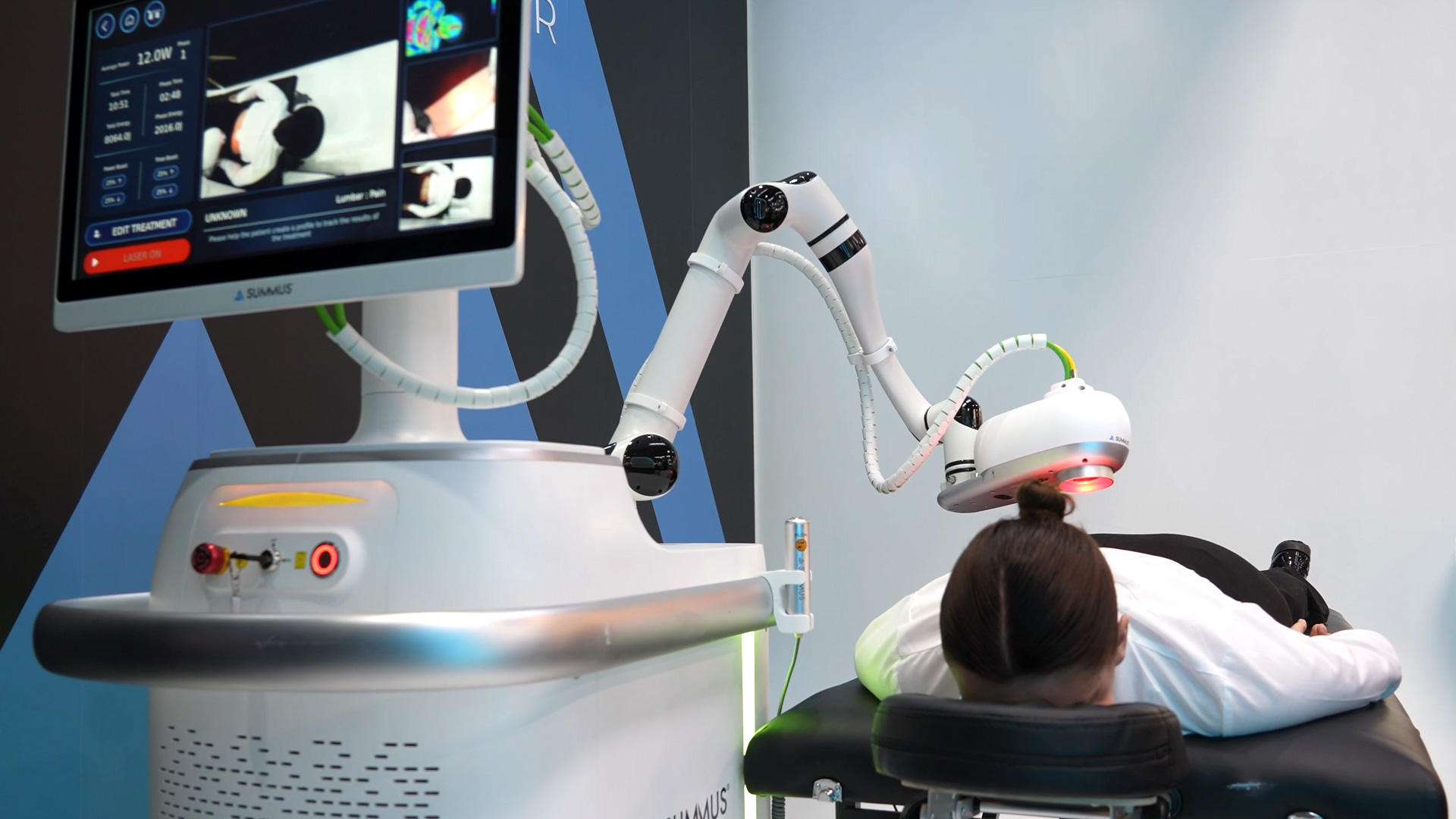 Iris automated laser technology pain therapy with AI Summus